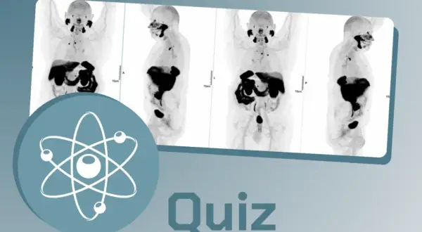 Images de médecine nucléaire, montrant des scans corporels en coupe. Un symbole atomique et le mot "Quiz" sont superposés.