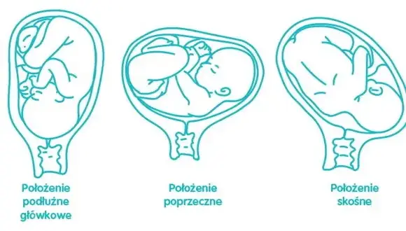 Kiedy płód układa się do porodu i co to oznacza dla mamy?