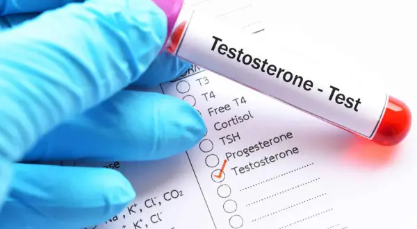 Rękawiczka w niebieskiej rękawiczce trzyma probówkę z krwią do badania. Na formularzu zaznaczono "Testosterone", co jest kluczowe, jak sprawdzić poziom testosteronu.