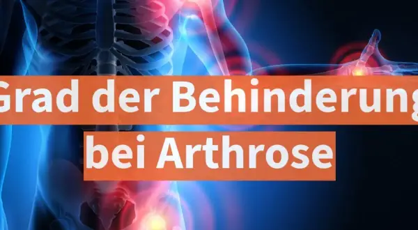 Grafik zeigt menschlichen Körper mit schmerzenden Gelenken. Text: "Grad der Behinderung bei Arthrose".
