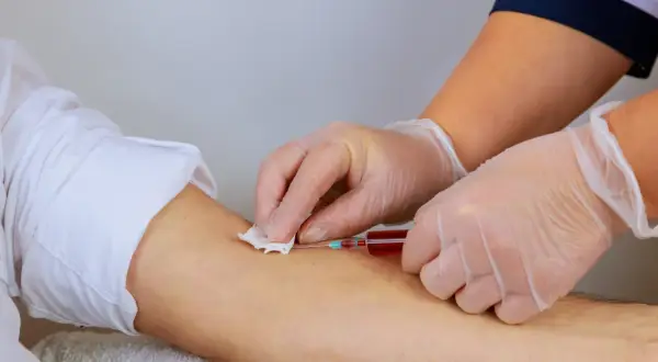 Pobieranie krwi do badania, które może pomóc znaleźć szybki sposób na podniesienie hemoglobiny.
