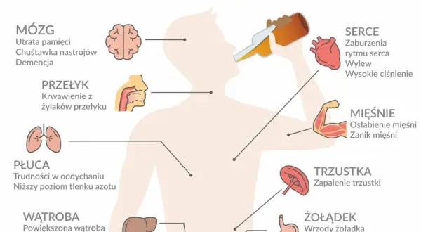 Ilustracja pokazuje skutki uzależnienia od alkoholu: problemy z mózgiem, sercem, płucami, wątrobą, żołądkiem, trzustką i mięśniami.