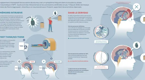 Le TSPT se manifeste par des souvenirs intrusifs. L'image illustre les connexions cérébrales altérées chez les personnes souffrant de TSPT, affectant l'oubli.