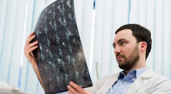 Lekarz analizuje zdjęcie rezonansu magnetycznego, szukając oznak krwiaka w głowie.