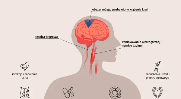 Gdy kręci się w głowie, przyczyną może być blokada tętnicy szyjnej, problemy z krążeniem mózgu, choroby ucha, mózgu, metaboliczne, sercowo-naczyniowe lub leki.