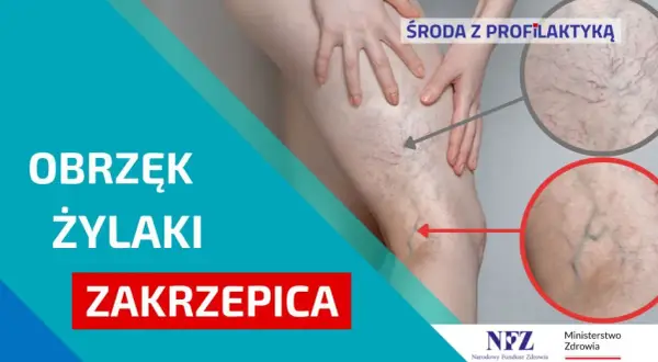 Zakrzepica: Jak skutecznie zapobiegać? Porady, które ratują życie