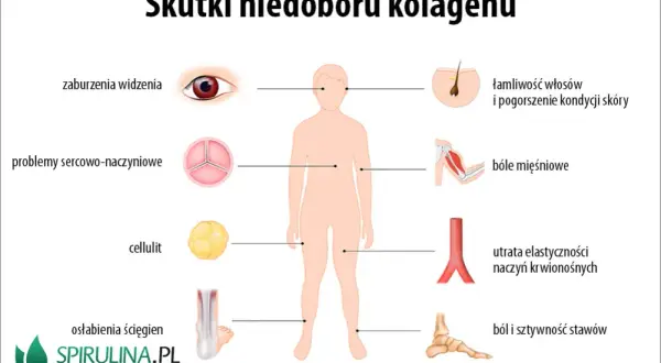 Objawy niedoboru kolagenu: Rozpoznaj i skutecznie uzupełnij!