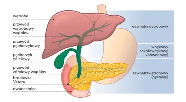 Anatomia dróg żółciowych. Ilustracja pokazuje wątrobę, pęcherzyk żółciowy i trzustkę, z zaznaczonymi przewodami, gdzie mogą pojawić się kamienie w przewodach żółciowych.
