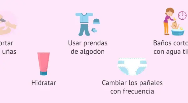 Consejos para el cuidado de la piel atópica del bebé: cortar uñas, hidratar, usar algodón, baños tibios y cambiar pañales.