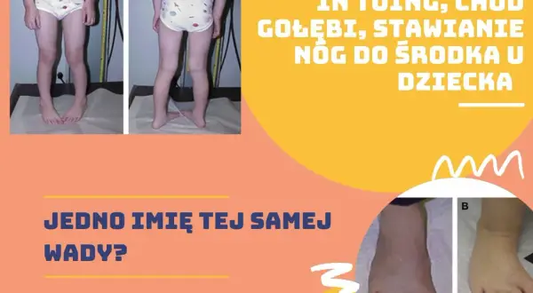 Dziecko z gołębim chodem, stawiające nogi do środka. Ćwiczenia na poprawę postawy.