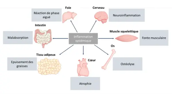 Schéma montrant l'inflammation systémique affectant le muscle squelettique, entraînant une fonte musculaire. D'autres effets incluent le cerveau, le foie, le cœur, les os, l'intestin, le tissu adipeux et la réaction de phase aiguë.