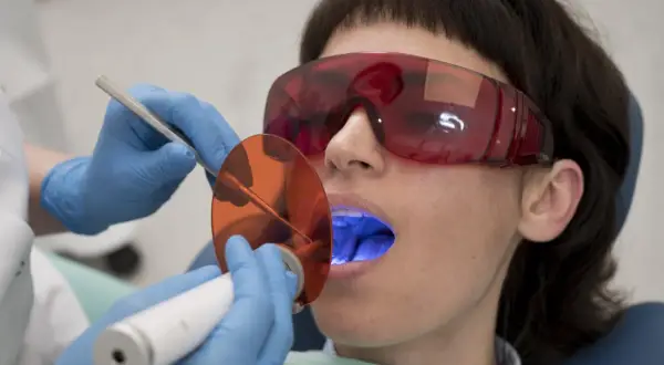Pacjentka w okularach ochronnych poddaje się zabiegowi stomatologicznemu. Dentysta używa lampy polimeryzacyjnej, która emituje niebieskie światło. Po piaskowaniu zębów, taka kawa z mlekiem smakuje jak nagroda.