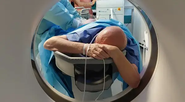 Pacjent przygotowany do zabiegu RIRS na NFZ, leżący na stole zabiegowym.