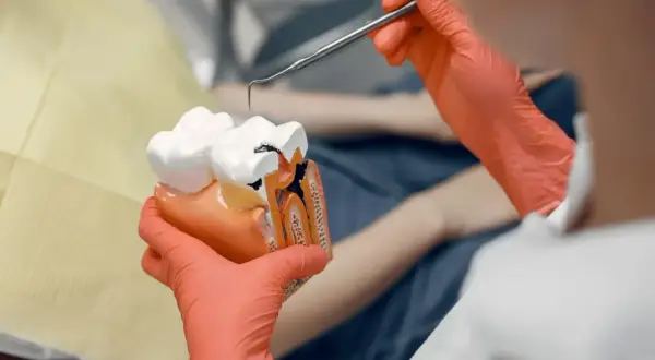 Model zęba pokazuje, co to endodoncja: leczenie kanałowe. Dentysta w rękawiczkach pokazuje uszkodzony ząb.