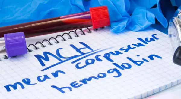 Na notatniku zapisano "MCH - mean corpuscular hemoglobin". Obok probówki z krwią, rękawiczki i stetoskop.