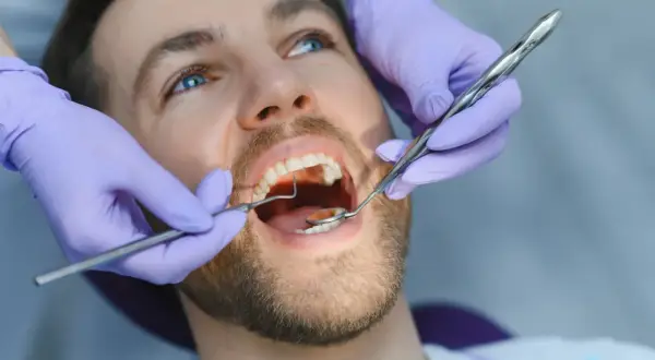 Dentysta usuwa kamień na zębach pacjenta za pomocą narzędzi stomatologicznych.