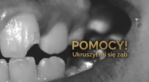 Zbliżenie na ukruszony ząb, z napisem "POMOCY! Ukruszył mi się ząb".