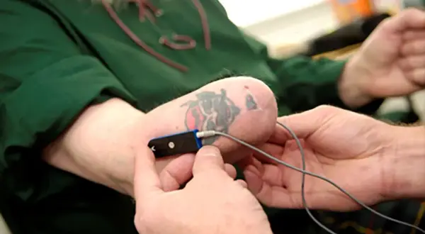 Un uomo con un tatuaggio sulla parte finale dell'avambraccio, forse a seguito di un'amputazione mano, tiene un dispositivo medico.