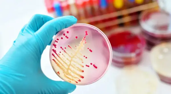 Rękawiczka w niebieskiej rękawiczce trzyma szalkę Petriego z czerwonymi koloniami bakterii, być może Klebsiella pneumoniae, na różowym podłożu.