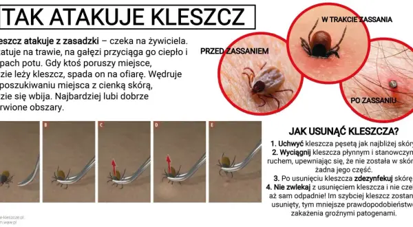 Zdjęcie przedstawia kleszcza **ixodes ricinus** przed, w trakcie i po zassaniu, a także instrukcję usuwania go.