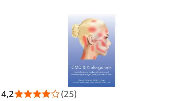 Kopfschmerzen und verspannte Kopfmuskulatur lockern: Illustration zeigt Schmerzpunkte am Kopf und Kiefer.