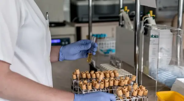 Laborantka w niebieskich rękawiczkach analizuje próbkę, która może zawierać dane o poziomie dehydrogenazy mleczanowej.