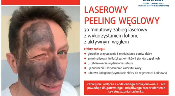 Mężczyzna z połową twarzy pokrytą czarną maską węglową po zabiegu Spectra Peel. Laserowy peeling węglowy nie powoduje skutków ubocznych jak zaczerwienienie czy złuszczanie.
