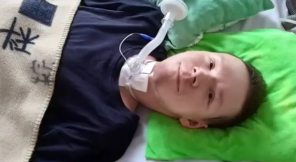 Chłopiec leży w łóżku z rurką tracheostomijną i podłączonym respiratorem.