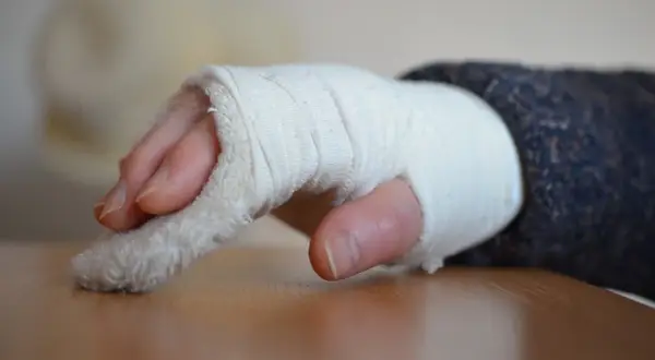 Jak długo trwa rehabilitacja po złamaniu nadgarstka? Sprawdź, co wpływa na czas powrotu do zdrowia