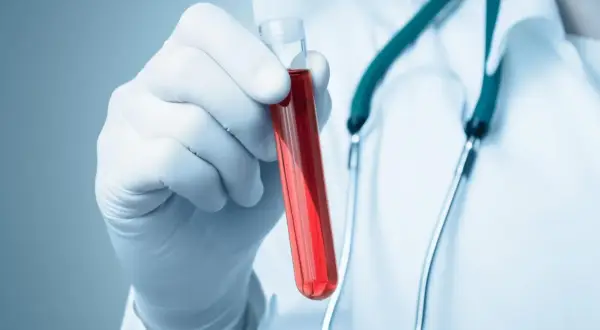 Ręka w białej rękawiczce trzyma probówkę z czerwoną cieczą, prawdopodobnie badanie na obecność fibrynogenu. Stetoskop na szyi lekarza.