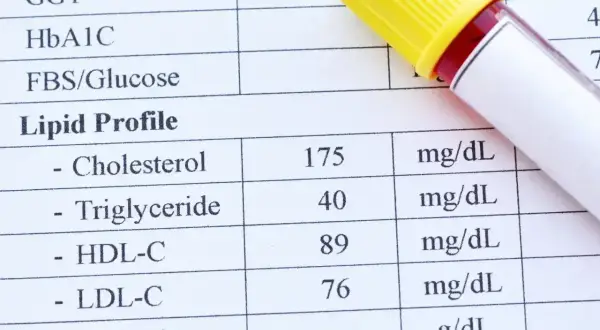 Wynik lipidogramu: cholesterol 175, trójglicerydy 40. Co to są trójglicerydy? To tłuszcze we krwi.