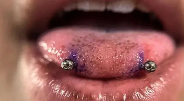 Język z dwoma kolczykami, przypominającymi snake eye piercing. Widać fioletowy ślad po markerze.