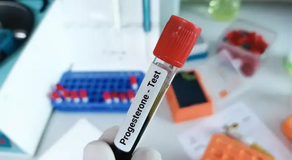 Probówka z napisem "Progesterone - Test" w laboratorium. Badanie progesteronu u kobiet jest kluczowe w diagnostyce cyklu miesiączkowego i ciąży.