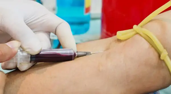 Jak przygotować się do badania cholesterolu, aby uniknąć błędów