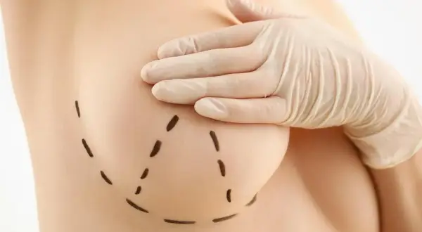 Opuchlizna po operacji biustu: Kiedy ustąpi? Skuteczne porady!