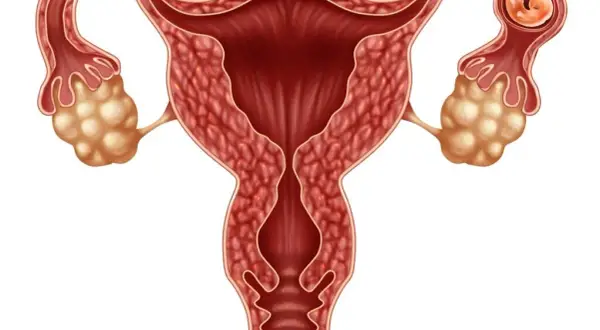 Ciąża pozamaciczna: Objawy, diagnostyka, leczenie. Co musisz wiedzieć?