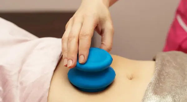 Dłoń terapeuty wykonuje masaż brzucha niebieskimi bańkami. Choć masaż bańką chińską efekty uboczne są rzadkie, warto znać potencjalne skutki.