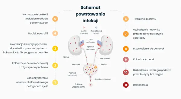 Schemat powstawania infekcji dróg moczowych, od zanieczyszczenia do bakteriemii. Czy zapalenie pęcherza jest zaraźliwe? Schemat pokazuje drogę infekcji.