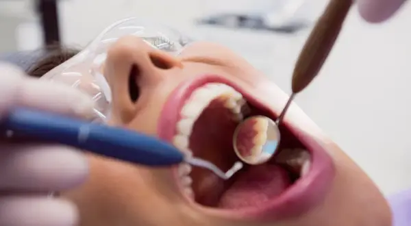 Zabieg piaskowania zębów w gabinecie stomatologicznym. Dentysta używa lusterka i piaskarki do oczyszczenia uzębienia.