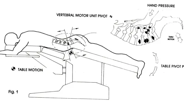 Ilustracja pokazuje technikę terapii manualnej kręgosłupa, która może pomóc w odpowiedzi na pytanie: czy wypuklina może się cofnąć.