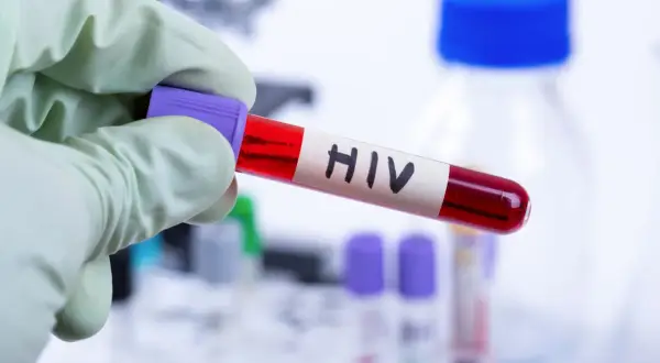 Rękawiczka ochronna trzyma probówkę z krwią oznaczoną "HIV". W tle widać sprzęt laboratoryjny, sugerujący badania nad wirusem i jego objawami u mężczyzn.