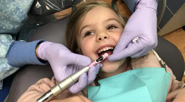 Uśmiechnięta dziewczynka przechodzi zabieg lapisowania zębów. Dentysta w rękawiczkach delikatnie czyści jej ząbki.