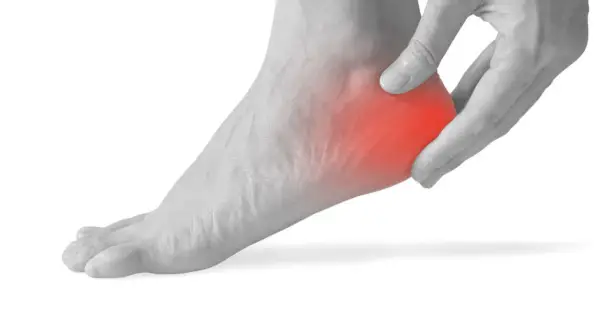 Mano che preme sul tallone sinistro, evidenziato in rosso, per indicare dolore al tallone sinistro a riposo.