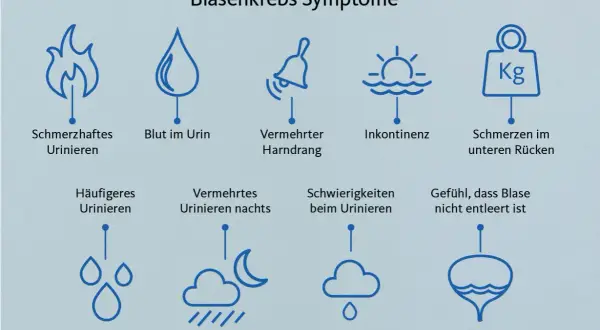 Grafik zeigt Symptome von Blasenkrebs: schmerzhaftes Urinieren, Blut im Urin, Harndrang, Inkontinenz, Rückenschmerzen, häufiges Urinieren, nächtliches Urinieren, Schwierigkeiten beim Urinieren, Gefühl der unvollständigen Blasenentleerung. Ein blasen tu...