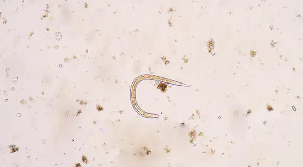 Mikroskopowy obraz nicienia w próbce, otoczony drobnymi cząstkami.