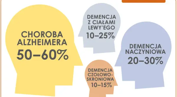 Otępienie: choroba mózgu czy umysłu? Poznaj medyczną klasyfikację