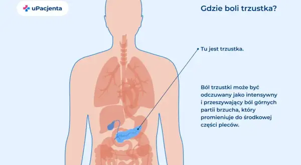 Anatomia człowieka z zaznaczoną trzustką. Ból trzustki odczuwany jest w górnej części brzucha, promieniując do pleców.
