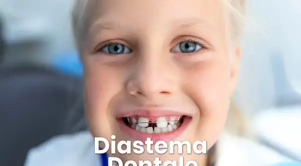 Bambina sorridente con apparecchio ortodontico che corregge lo spazio tra i denti.