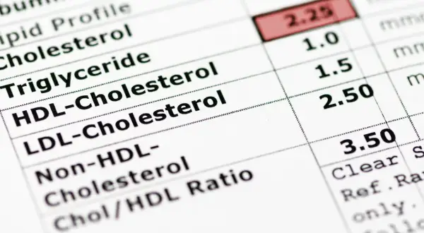 Wyniki badań krwi: cholesterol, triglicerydy. Czas oczekiwania na wyniki zależy od laboratorium.