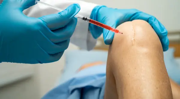 Jak długo boli kolano po kwasie hialuronowym? Oczekiwania i porady